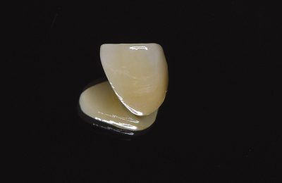 ジルコニアクラウン